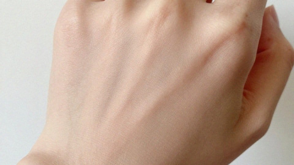 Jak wyglądają brązowe przebarwienia skóry?