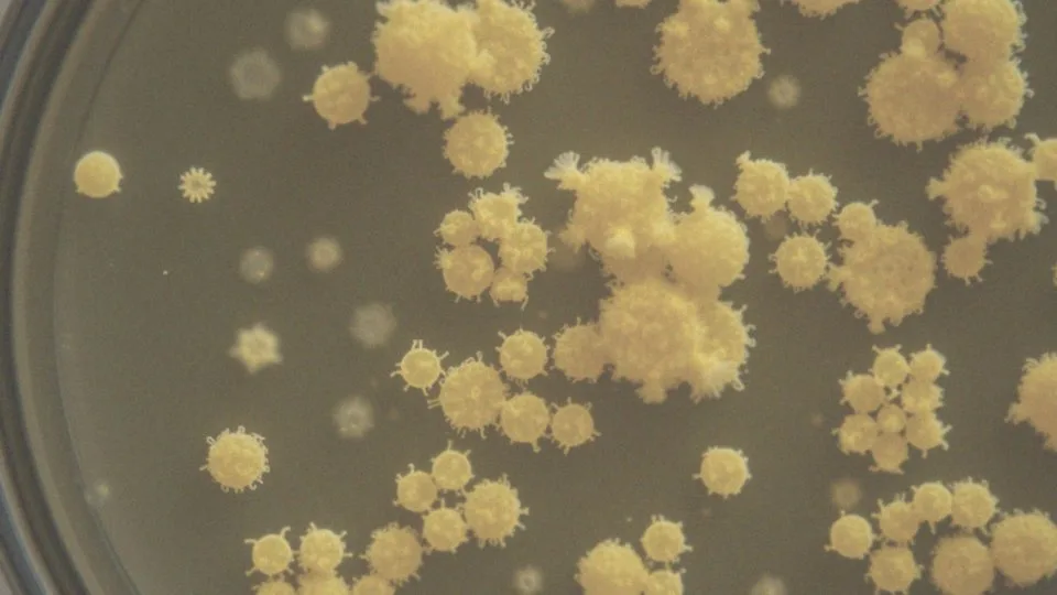 Jakie bakterie są odpowiedzialne za produkcję siarkowodoru?